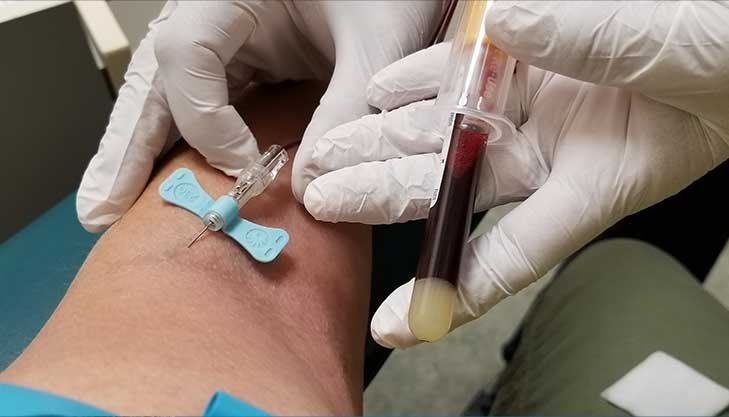Pourquoi le dépistage précoce du cancer reste un enjeu majeur Pourquoi le dépistage précoce du cancer reste un enjeu majeur